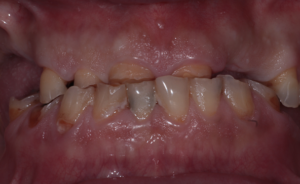 Digital Dentist
