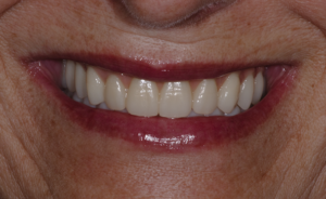 Digital Dentist
