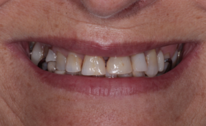 Digital Dentist